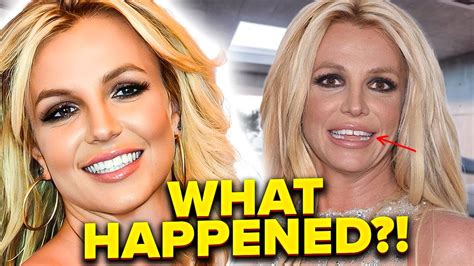 britney spears teeth|Britney Spears Full Teeth Transformation Is A Shocking Sight